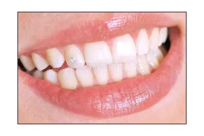 Budget Dental photo