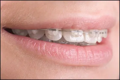 Budget Dental photo