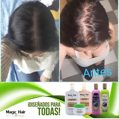 Magic Hair Oficial photo