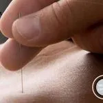 Nyon Acupuncture logo